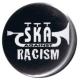 Zum 37mm Button "Ska against racism Trompete" für 1,00 € gehen.